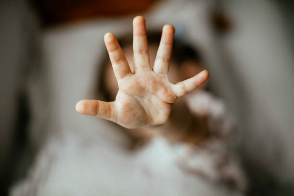 Sexueller Kindesmissbrauch